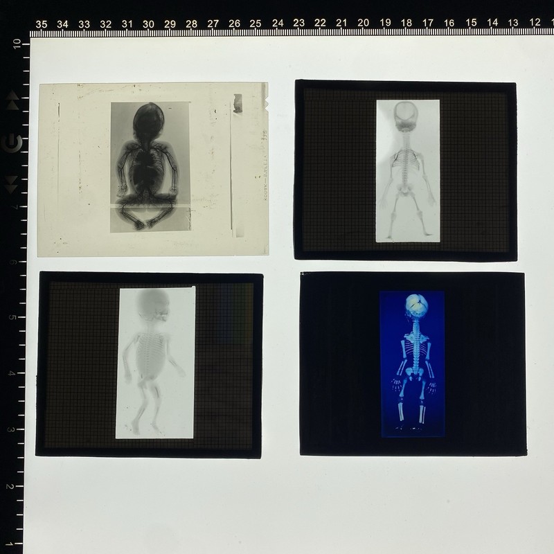Antique Medical Slides Fetal Skeleton Embryology Anatomy Oddities Macabre Curio