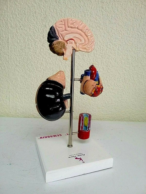 Desk Model of Arterial Hypertension Pharmacy Model Hard Plastic. Original box. gallery
