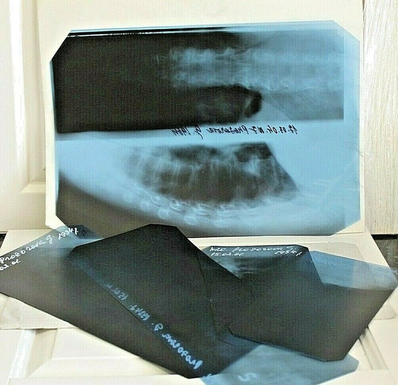 Medical plates fluorography vintage USSR Latvia.Large and small sizes 5 pcs.