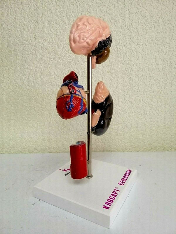 Desk Model of Arterial Hypertension Pharmacy Model Hard Plastic. Original box.