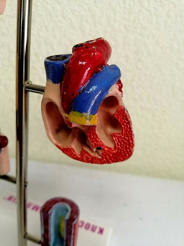 Desk Model of Arterial Hypertension Pharmacy Model Hard Plastic. Original box. gallery