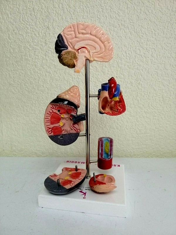 Desk Model of Arterial Hypertension Pharmacy Model Hard Plastic. Original box. gallery