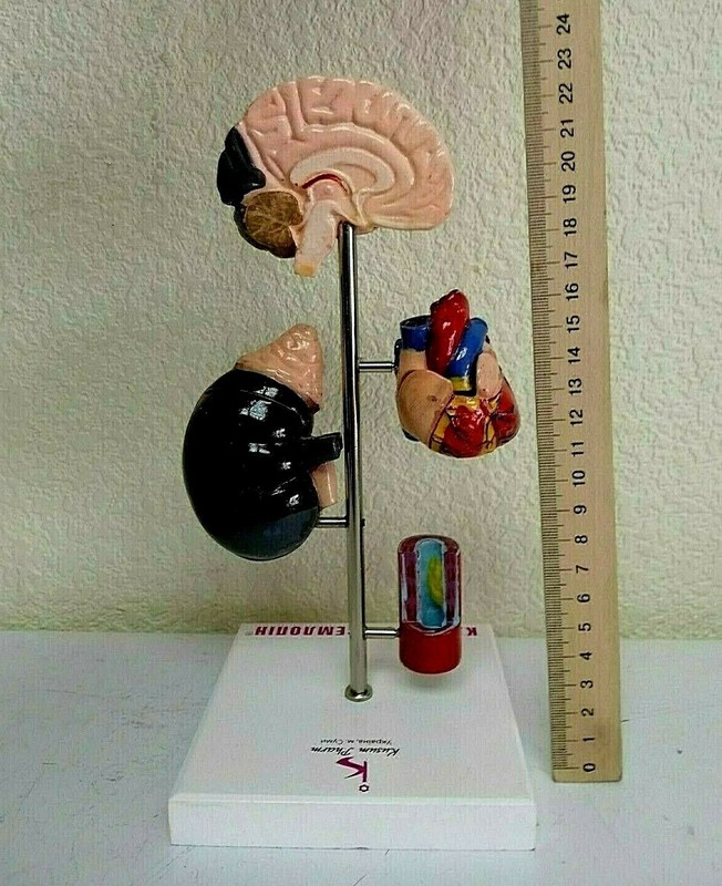 Desk Model of Arterial Hypertension Pharmacy Model Hard Plastic. Original box. gallery