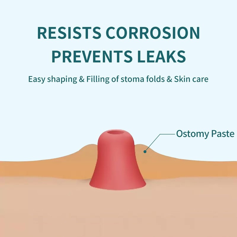 ovand Ostomy Filler Paste 2 oz,Stoma Skin Barrier Paste,Ostomy 1 Tube gallery