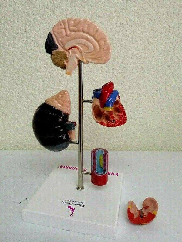 Desk Model of Arterial Hypertension Pharmacy Model Hard Plastic. Original box. gallery