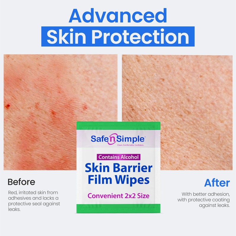 Skin Barrier Wipes with Alcohol - 2" x 2" - 50 Count - Skin Prep Pads for Ost... gallery