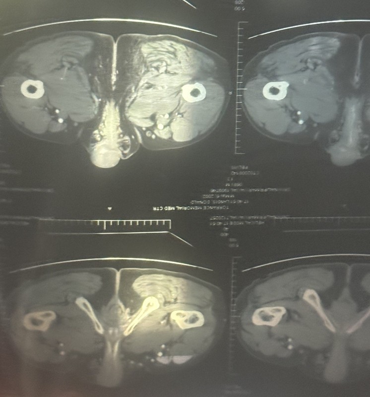 Lot of 28 MRI CT Cat Scans, pelvis X-Rays, Halloween, Oddity 17x14 inch 4 lbs
