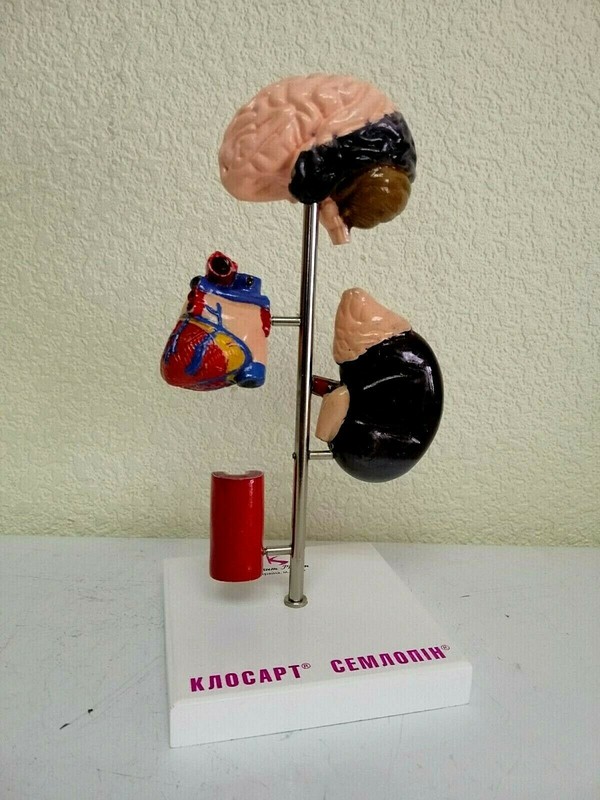 Desk Model of Arterial Hypertension Pharmacy Model Hard Plastic. Original box. gallery
